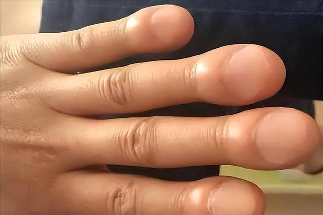  当你以为只是老毛病犯了时，身体可能在发出最后的求救 健康养生